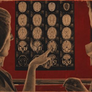 CEREBRAL COMPASS