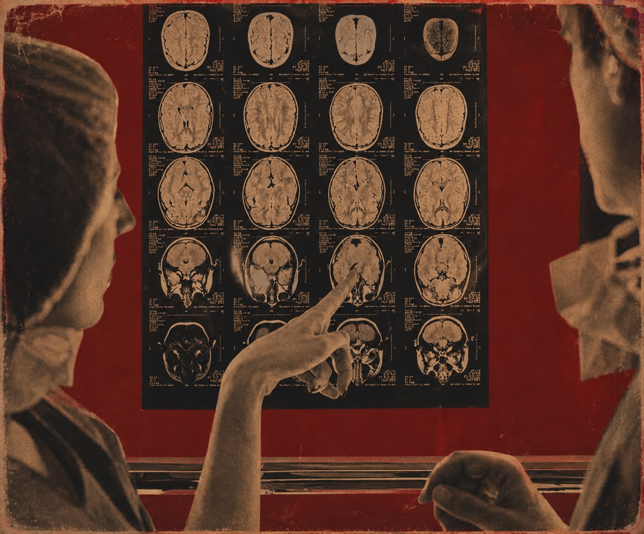Neurology and neurosurgery workshop